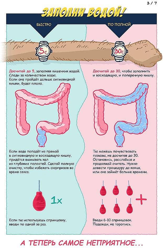 Что такое анальный секс?