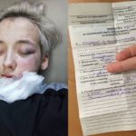 лесбиянку