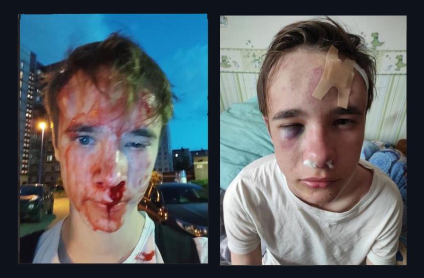 Подростка в Петербурге зверски избили из-за серёжки в ухе