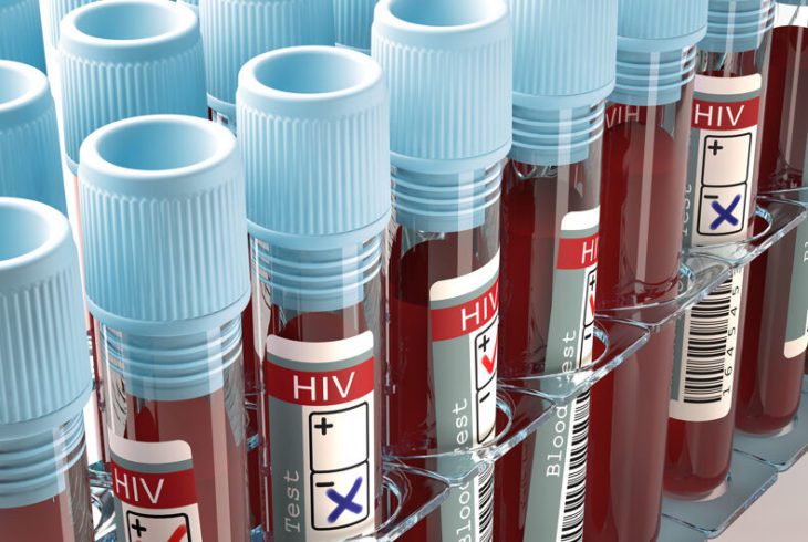 Прихована пандемія: що відбувається з ВІЛ у Росії?