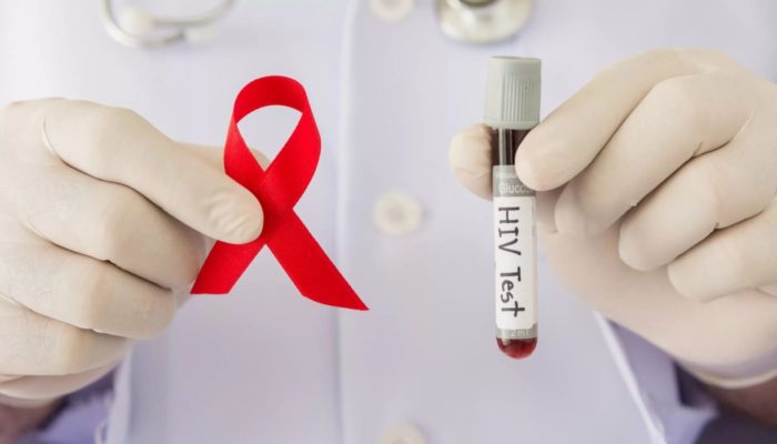 Тест на ВИЧ, статистика ВИЧ в России 2023