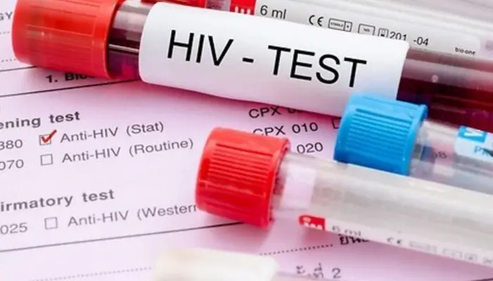 На изображении склянка с кровью и подпись ВИЧ тест (HIV test)